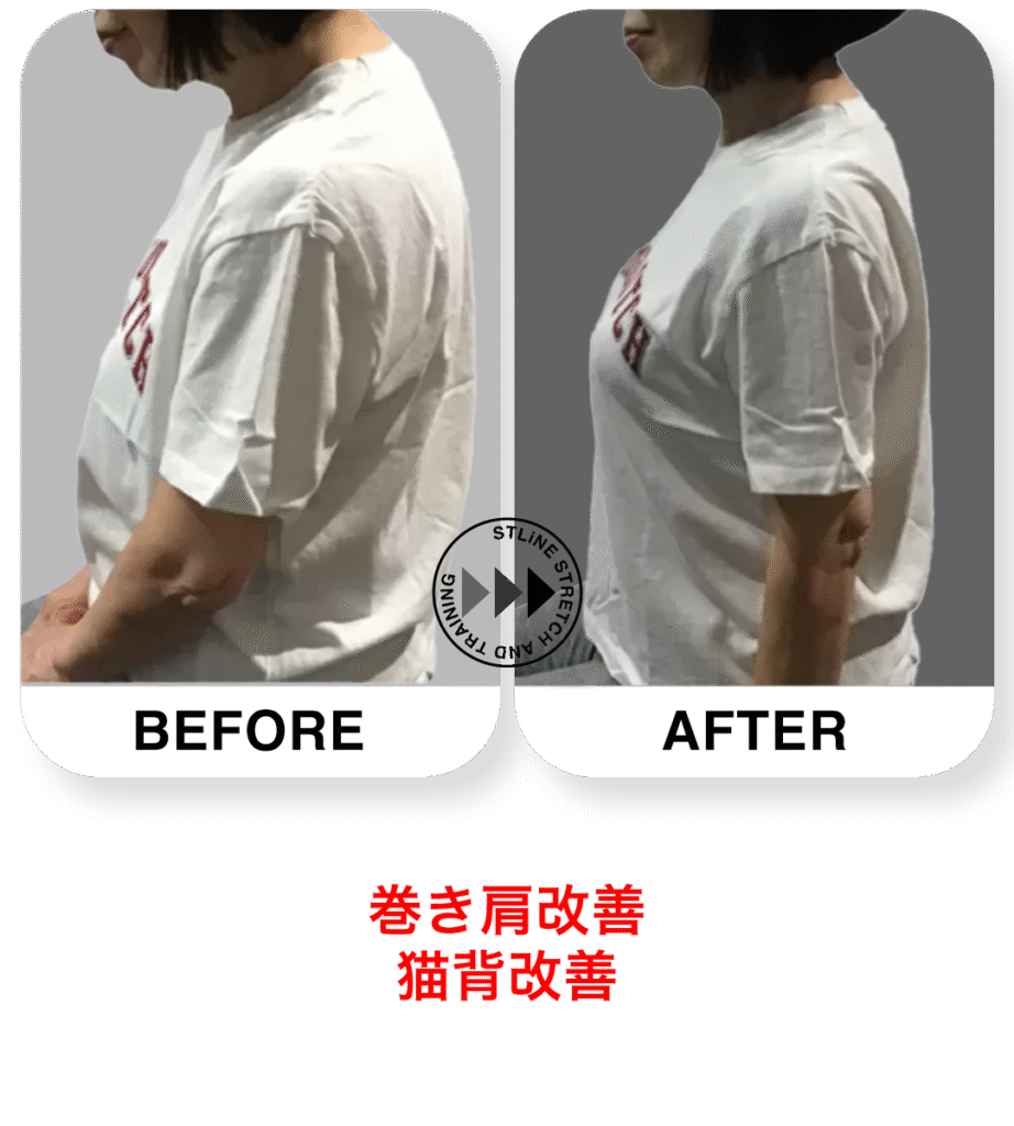 70代女性の姿勢改善 ビフォーアフター｜パーソナルジムSTLiNE早稲田店