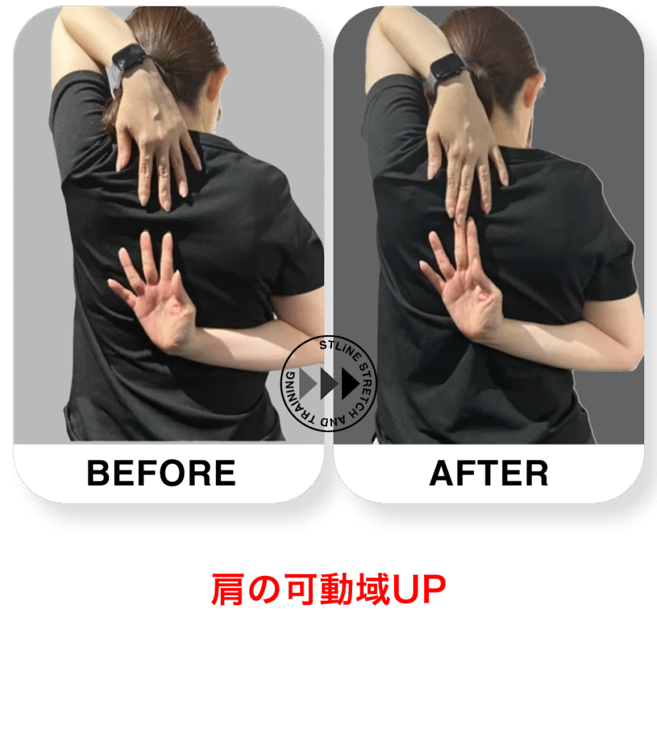 30代女性の姿勢改善 ビフォーアフター｜パーソナルジムSTLiNE早稲田店